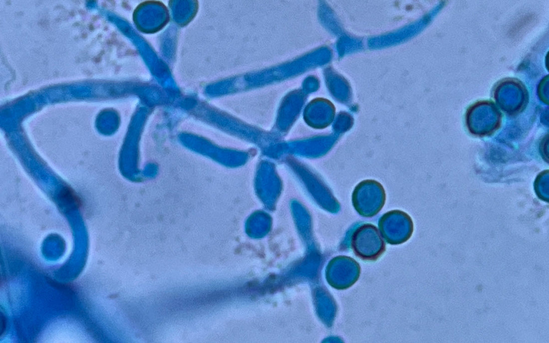 Trichoderma fungi